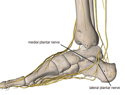medial plantar foot pain