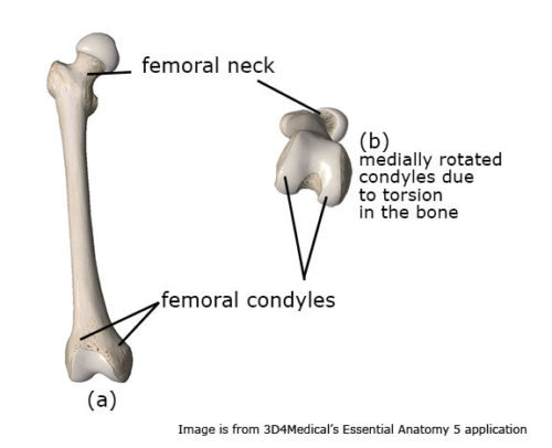 Miserable Malalignment Syndrome - Academy Of Clinical Massage