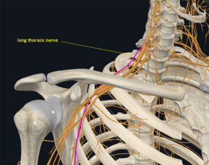 Image of the long thoracic nerve in relation to the brachial plexus